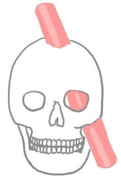 Bild 2: Phineas Gage mit Eisenstange